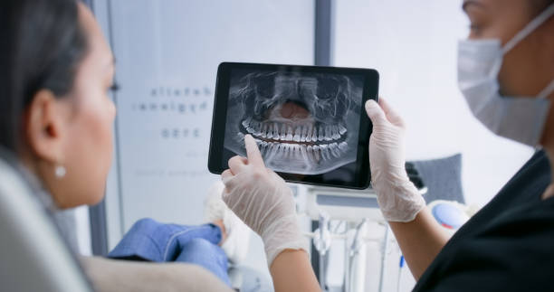 Licensed Wisdom Tooth Removal service in Russellville, AR - Smile Center Dentistry